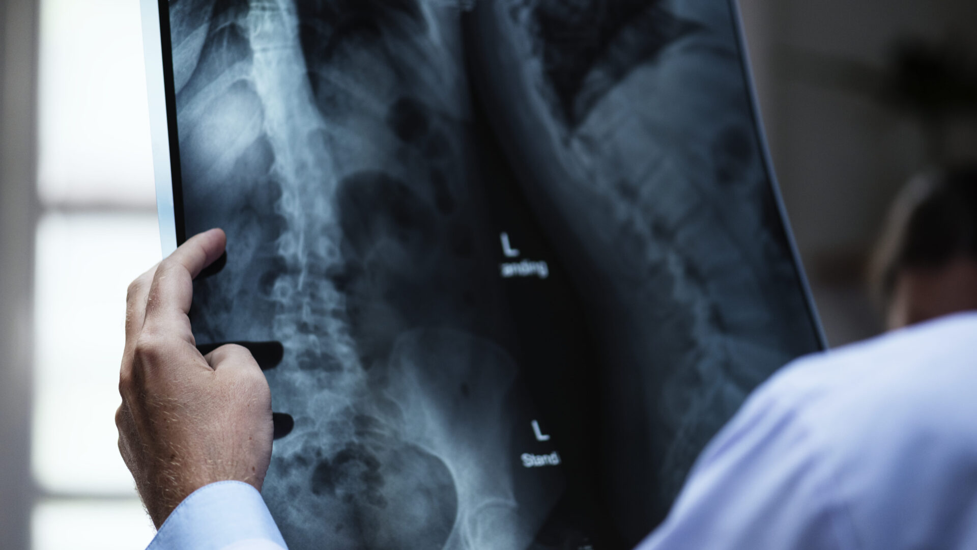 imagen radiologia