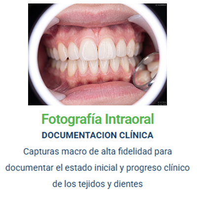 imagen de fotografia intraoral