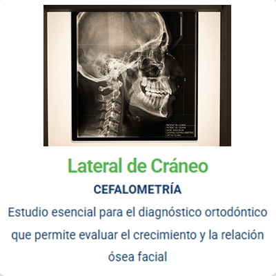 imagen de lateral de craneo